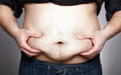 Homeopathy Treatment for Obesity