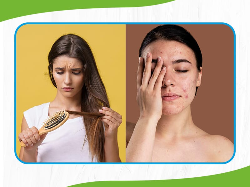 Skin & Hair Disorder