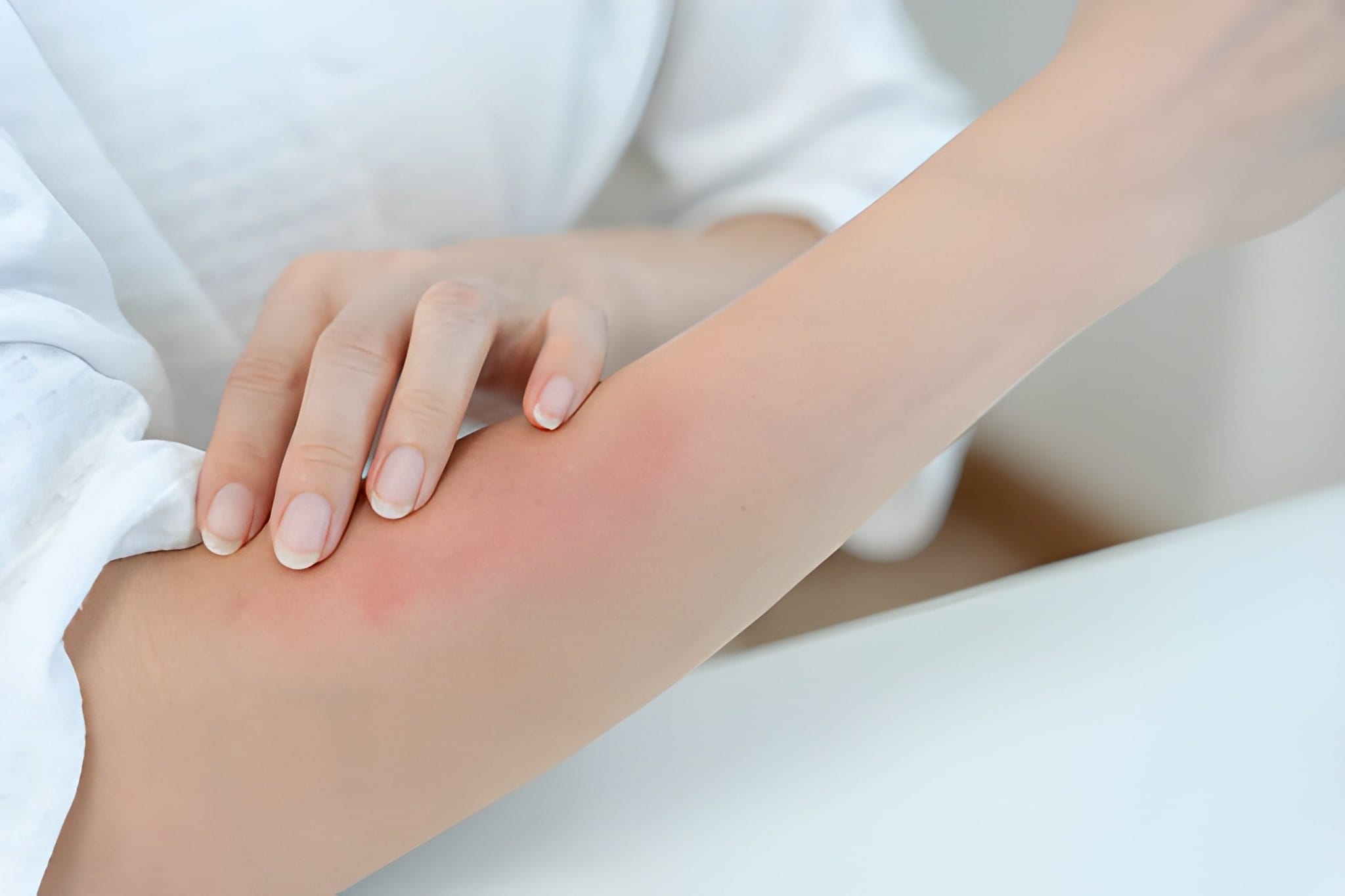 Homeopathy for Skin Allergy